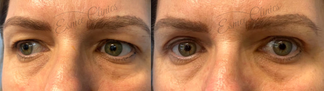 Before and After img